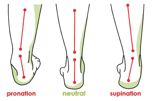 Wellness Buddy lace up shoe - orthotic insole